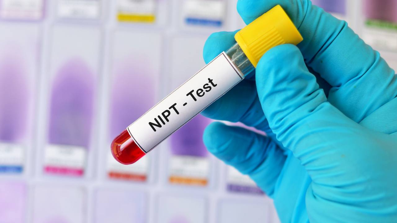 מהי בדיקת  NIPT